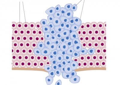 Cancro / Divisione Cellule